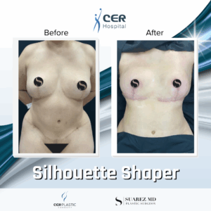 Silhouette Shaper – 145