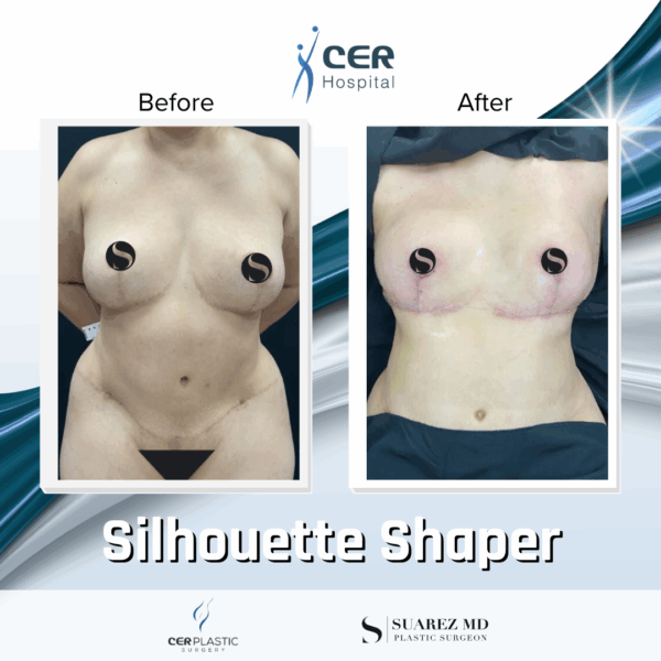 Silhouette Shaper - 145
