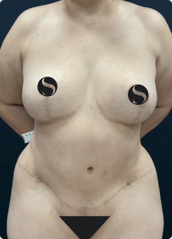 Silhouette Shaper - 145 - Image 3
