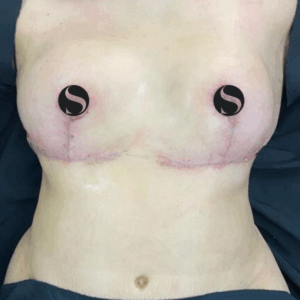 Silhouette Shaper – 145