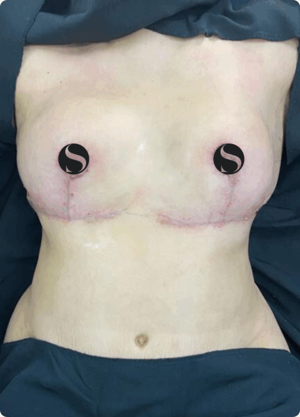 Silhouette Shaper - 145 - Image 2