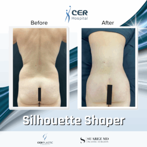 Silhouette Shaper – 284