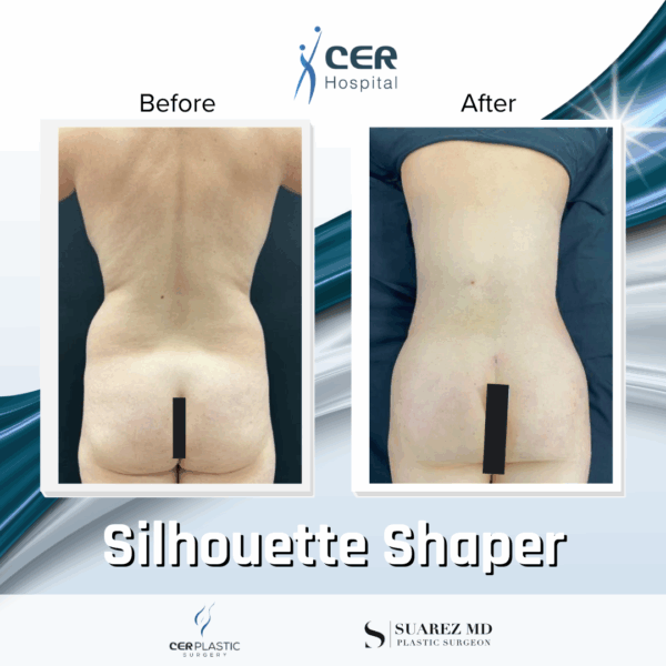 Silhouette Shaper - 284