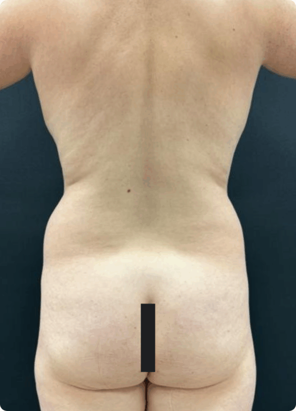 Silhouette Shaper - 284 - Image 3