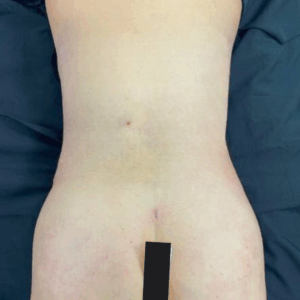 Silhouette Shaper – 284