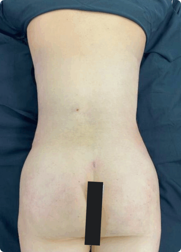 Silhouette Shaper - 284 - Image 2