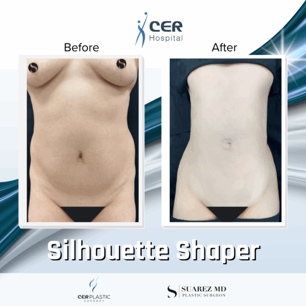Silhouette Shaper - 284 - Image 4