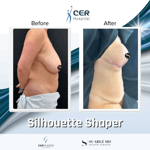Silhouette Shaper - 042 - Image 4