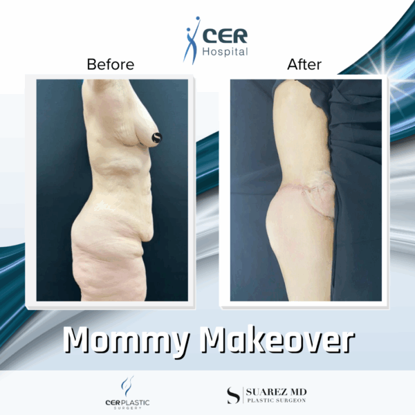 Mommy Makeover - 311 - Image 14