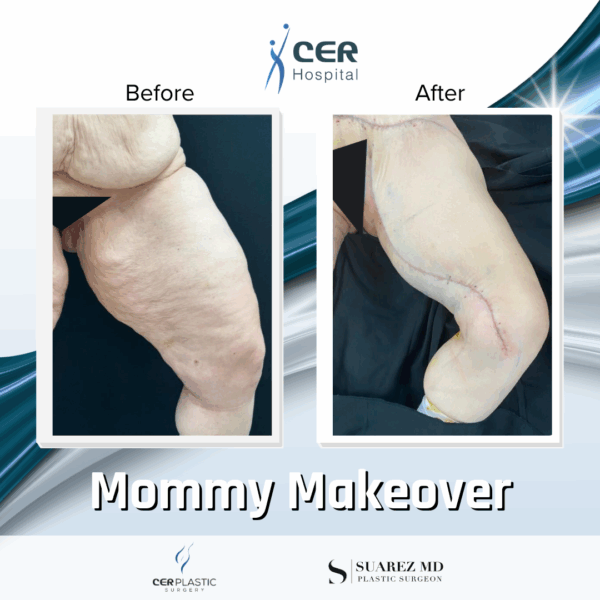 Mommy Makeover - 311 - Image 15