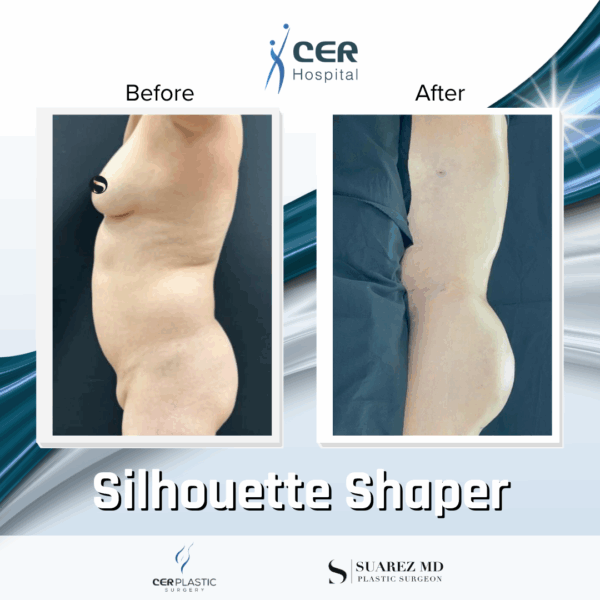 Silhouette Shaper - 284 - Image 5
