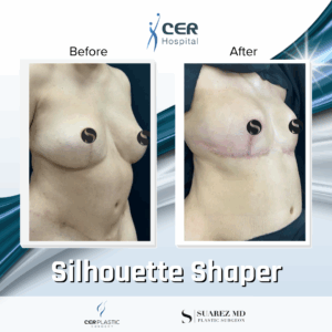 Silhouette Shaper – 145