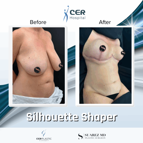 Silhouette Shaper - 042 - Image 5