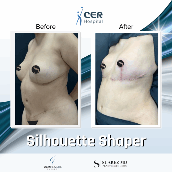 Silhouette Shaper - 145 - Image 5