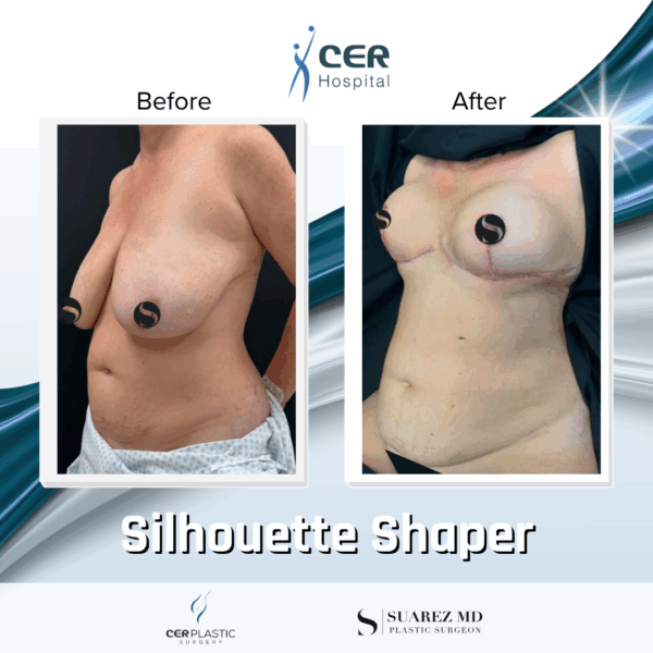 Silhouette Shaper - 042 - Image 6