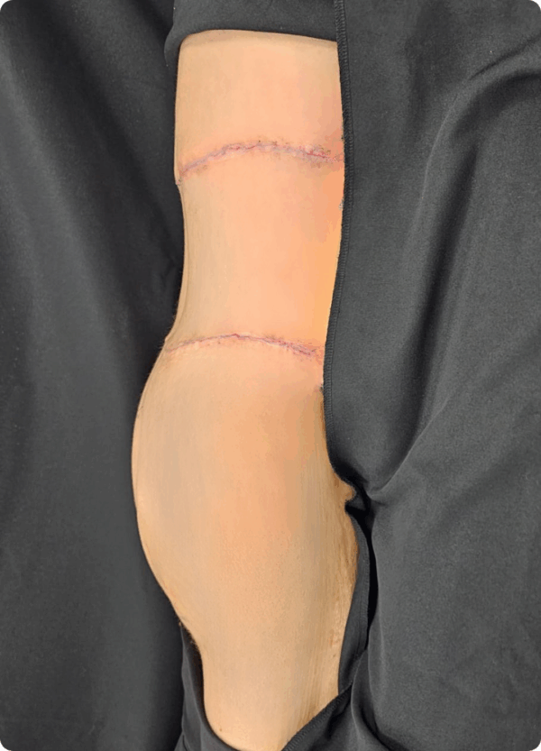 Body Lift - 20054 - Image 2