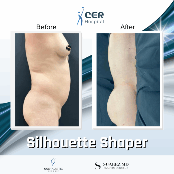 Silhouette Shaper - 284 - Image 7