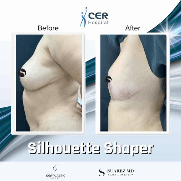 Silhouette Shaper - 145 - Image 6