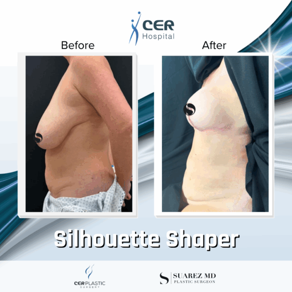 Silhouette Shaper - 042 - Image 7