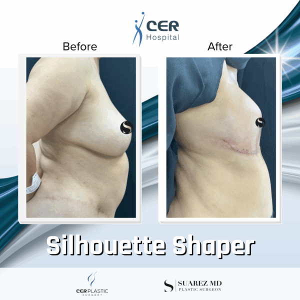 Silhouette Shaper - 145 - Image 7