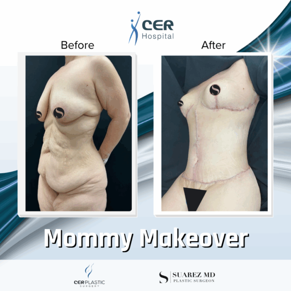 Mommy Makeover - 311 - Image 10