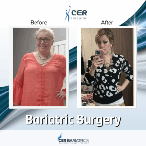 Bariatric Surgery