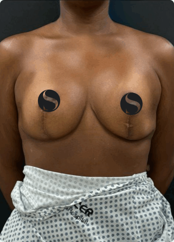 Implants Exchange - 5074 - Image 3