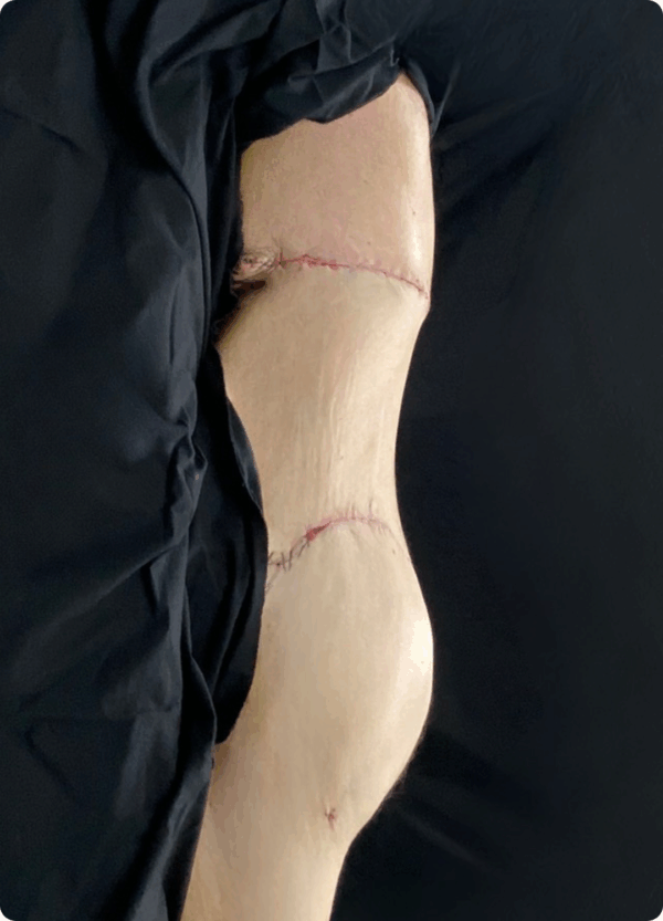 Body Lift - 8013 - Image 2