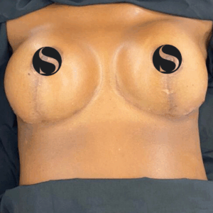 Implants Exchange – 5074