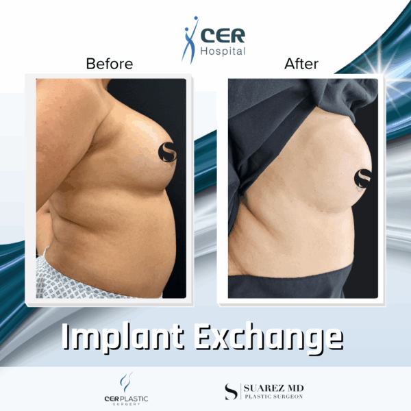 Implant Exchange - 24054 - Image 5