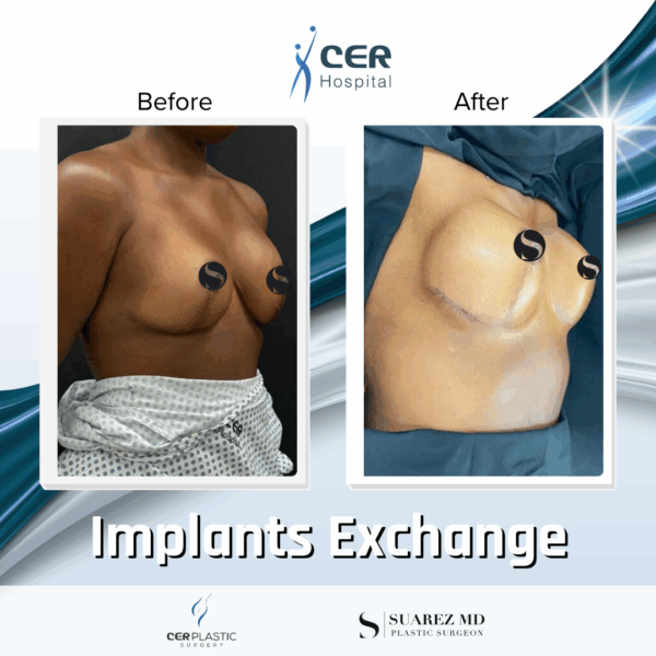 Implants Exchange - 5074 - Image 4