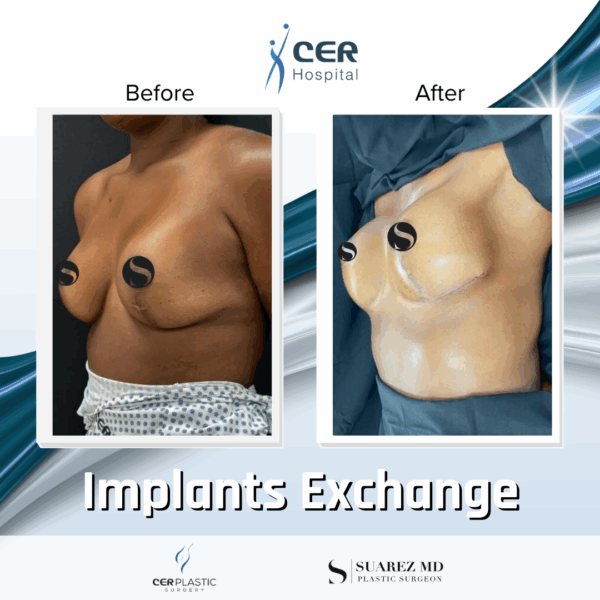 Implants Exchange - 5074 - Image 5