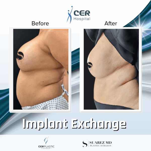 Implant Exchange - 24054 - Image 7