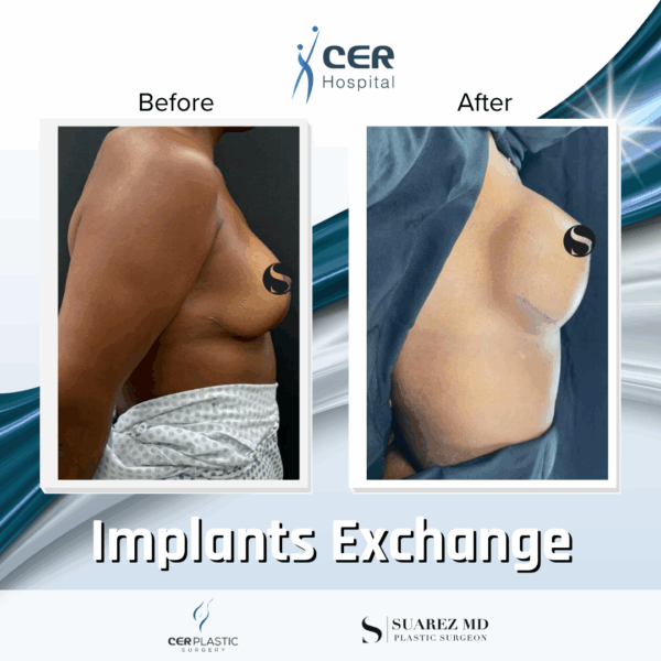 Implants Exchange - 5074 - Image 6