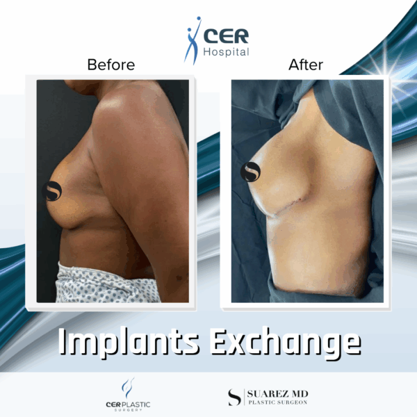 Implants Exchange - 5074 - Image 7