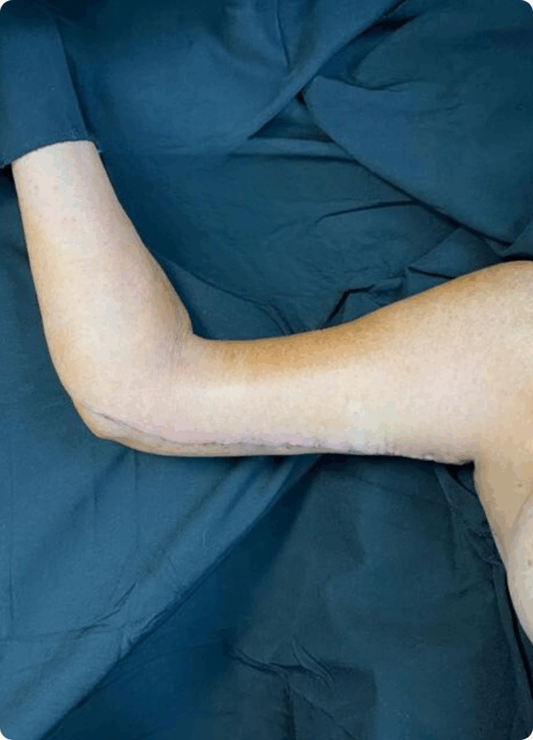 Body Lift - 18094 - Image 2