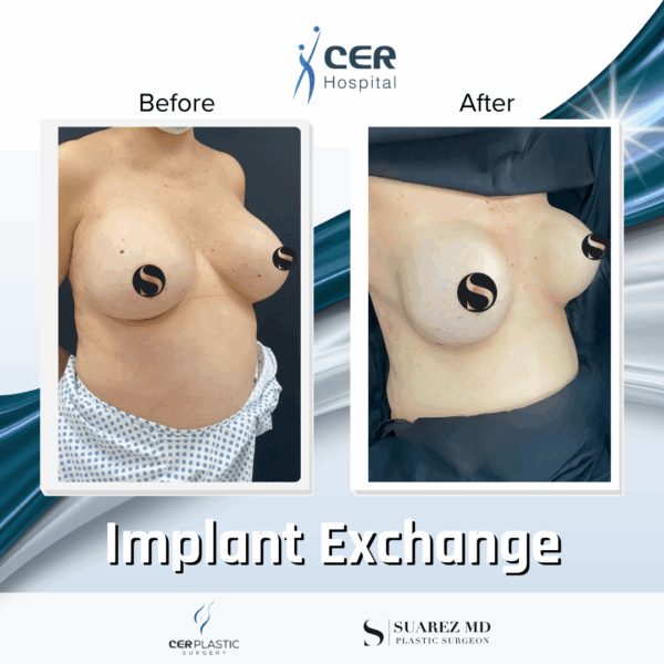 Implant Exchange - 09063 - Image 5