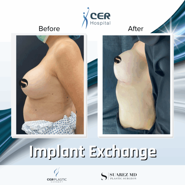 Implant Exchange - 09063 - Image 6