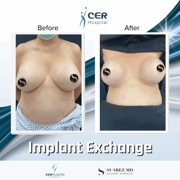 Implant Exchange - 09063 - Image 7