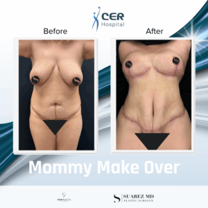 Mommy Make Over – 291025